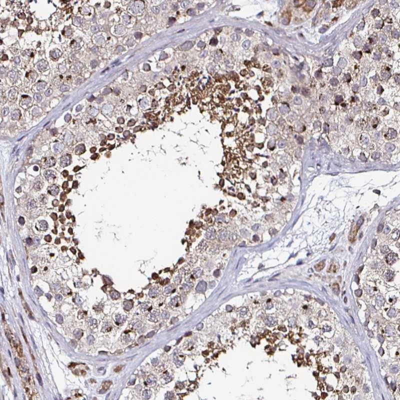ATG3/APG3 Antibody - BSA Free Immunohistochemistry: ATG3/APG3 Antibody - BSA Free [NBP2-37894]