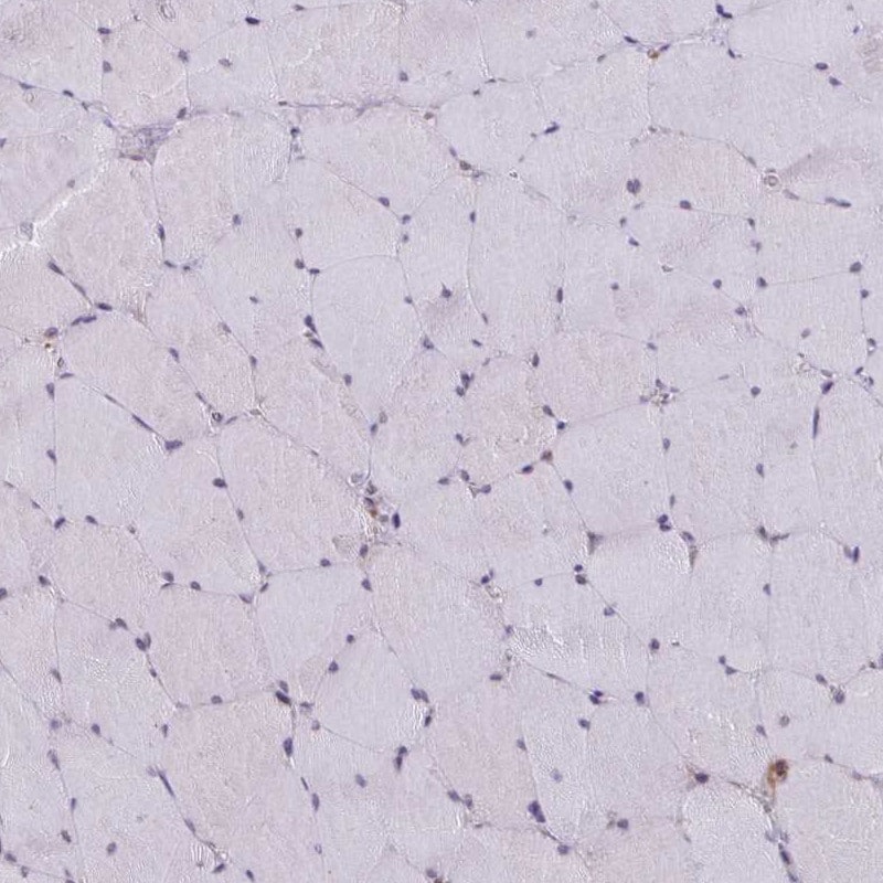 ATG3/APG3 Antibody - BSA Free Immunohistochemistry: ATG3/APG3 Antibody - BSA Free [NBP2-37894]