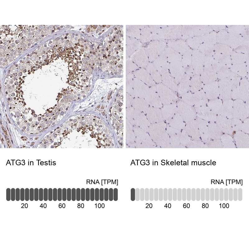 ATG3/APG3 Antibody - BSA Free Immunohistochemistry: ATG3/APG3 Antibody - BSA Free [NBP2-37894]