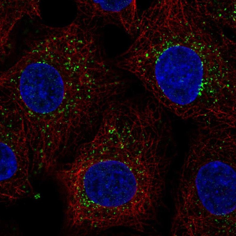 ZADH1 Antibody - BSA Free Immunocytochemistry/ Immunofluorescence: ZADH1 Antibody [NBP2-38122]