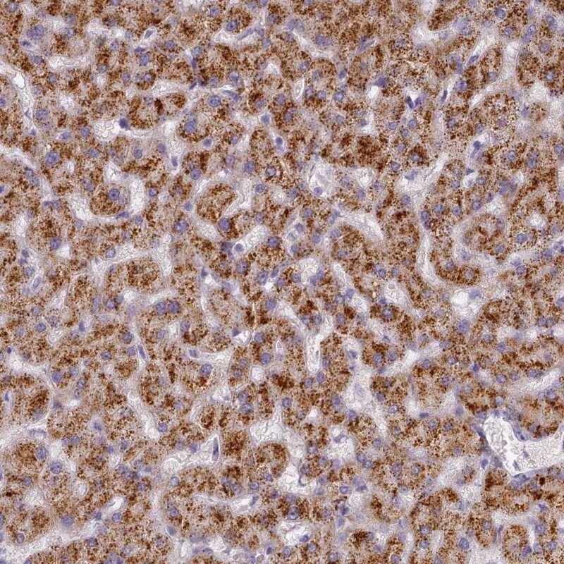 TYW1B Antibody - BSA Free Immunohistochemistry-Paraffin: TYW1B Antibody [NBP2-38128]