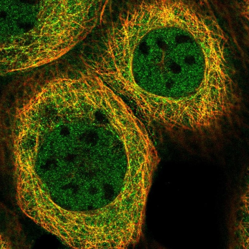 Absent in melanoma 1 Antibody - BSA Free Immunocytochemistry/ Immunofluorescence: Absent in melanoma 1 Antibody - BSA Free [NBP2-38170]