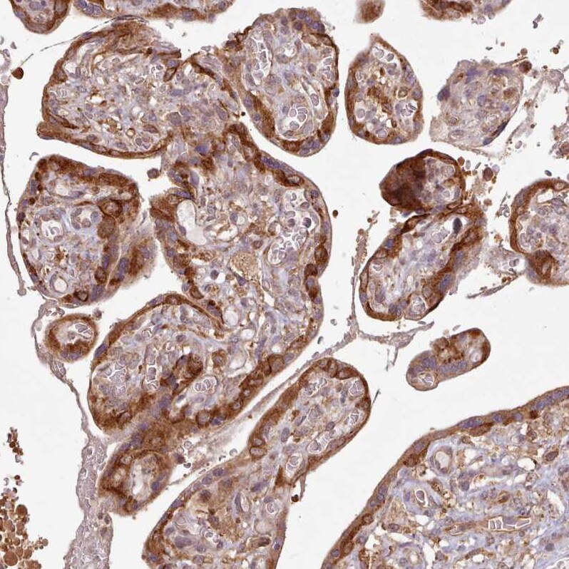 Absent in melanoma 1 Antibody - BSA Free Immunohistochemistry: Absent in melanoma 1 Antibody - BSA Free [NBP2-38170]