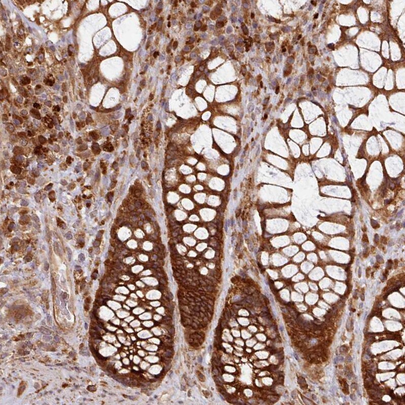 Absent in melanoma 1 Antibody - BSA Free Immunohistochemistry: Absent in melanoma 1 Antibody - BSA Free [NBP2-38170]