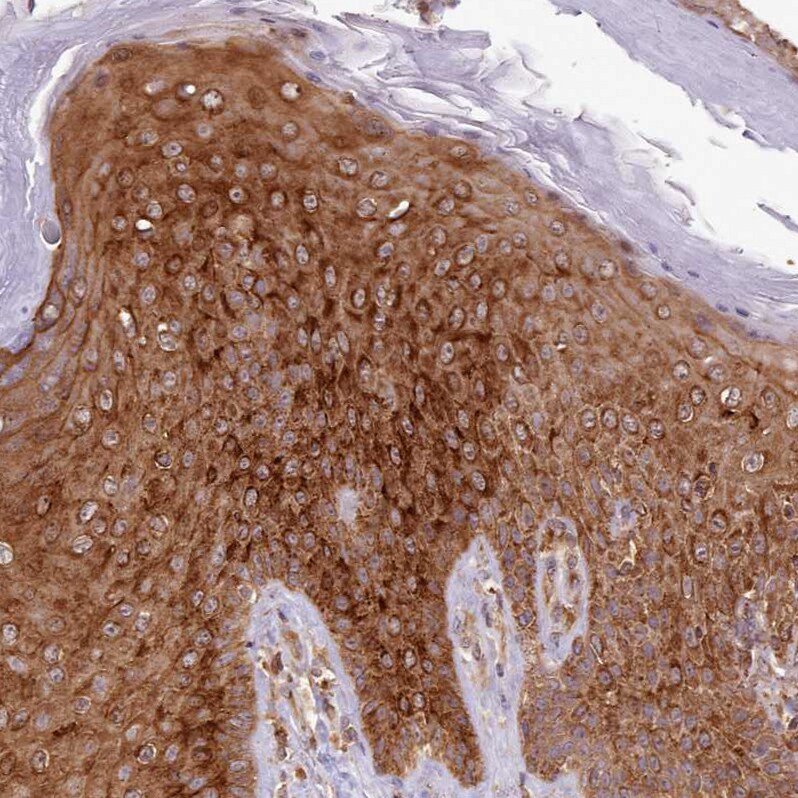 Absent in melanoma 1 Antibody - BSA Free Immunohistochemistry: Absent in melanoma 1 Antibody - BSA Free [NBP2-38170]