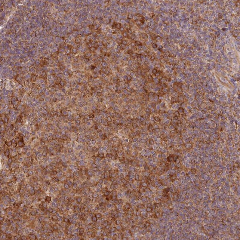 Absent in melanoma 1 Antibody - BSA Free Immunohistochemistry: Absent in melanoma 1 Antibody - BSA Free [NBP2-38170]