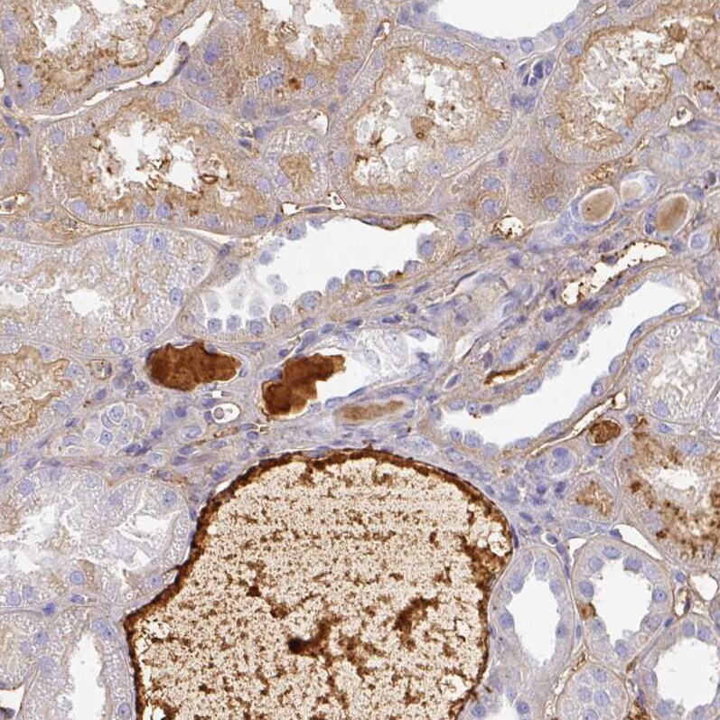 Albumin Antibody - BSA Free Immunohistochemistry-Paraffin: Albumin Antibody [NBP2-38174]