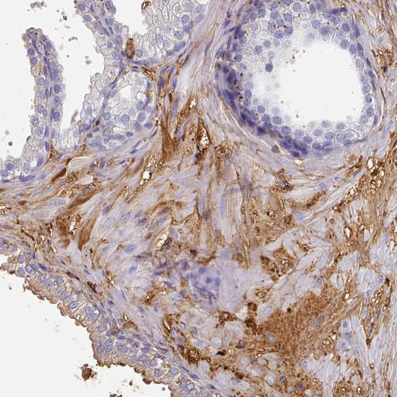 Albumin Antibody - BSA Free Immunohistochemistry-Paraffin: Albumin Antibody [NBP2-38174]
