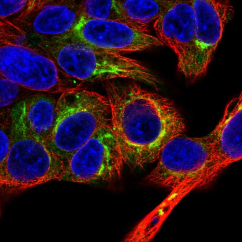Albumin Antibody - BSA Free Immunocytochemistry/ Immunofluorescence: Albumin Antibody [NBP2-38175]