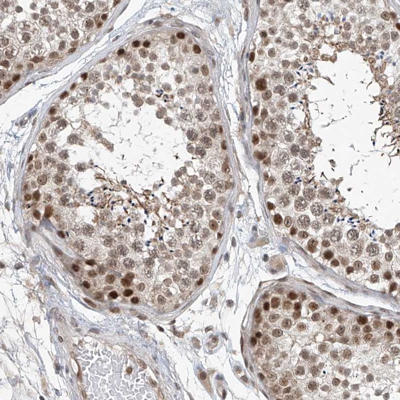 TAF8 Antibody - BSA Free Immunohistochemistry-Paraffin: TAF8 Antibody [NBP2-38188]