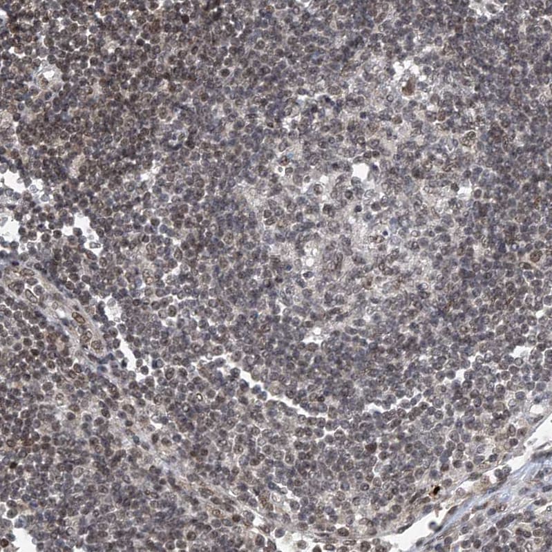 TAF8 Antibody - BSA Free Immunohistochemistry-Paraffin: TAF8 Antibody [NBP2-38188]