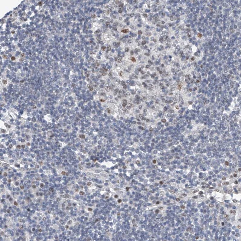 TAF8 Antibody - BSA Free Immunohistochemistry-Paraffin: TAF8 Antibody [NBP2-38189]