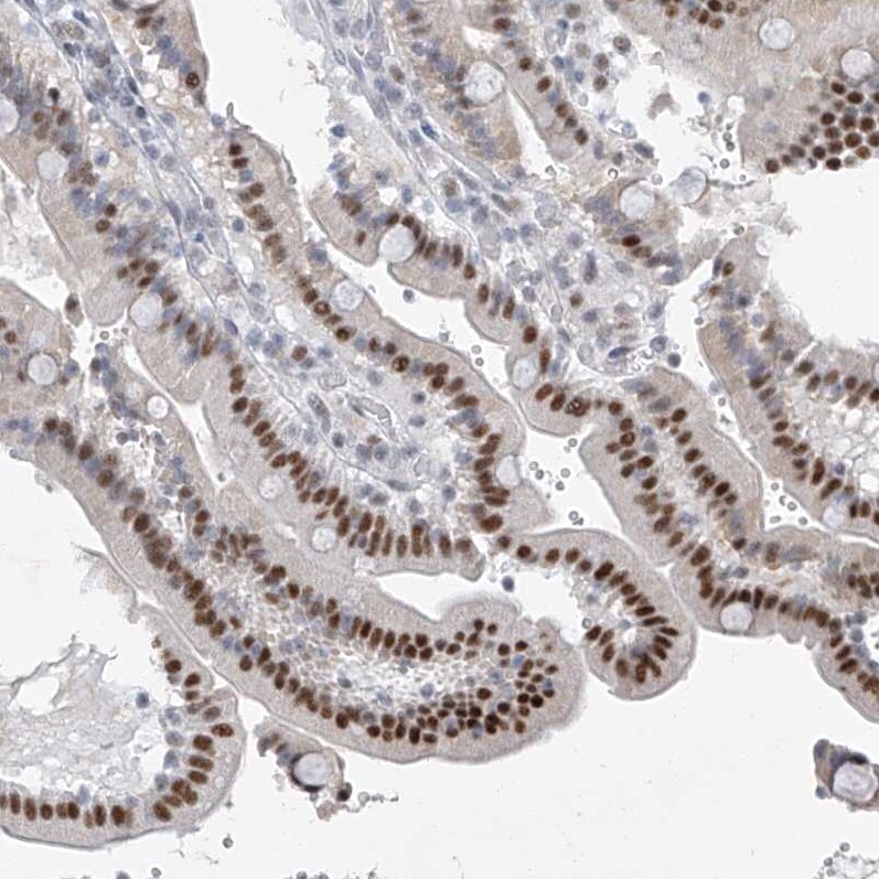 TAF8 Antibody - BSA Free Immunohistochemistry-Paraffin: TAF8 Antibody [NBP2-38189]
