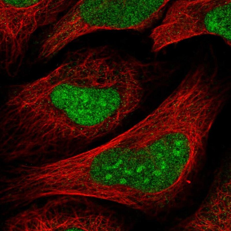 TSPYL1 Antibody - BSA Free Immunocytochemistry/ Immunofluorescence: TSPYL1 Antibody [NBP2-38191]