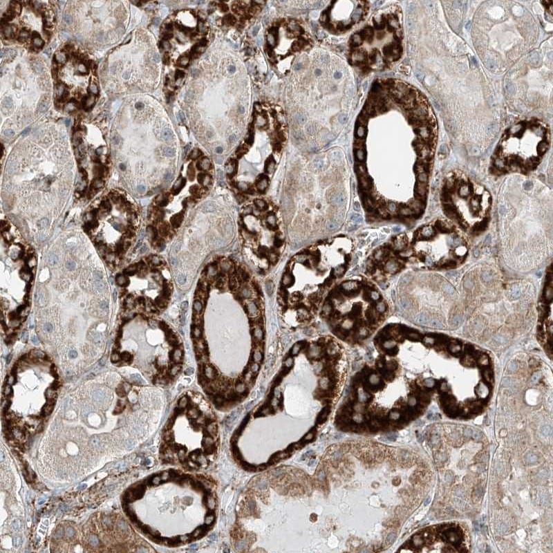 ABCC11 Antibody - BSA Free Immunohistochemistry: ABCC11 Antibody - BSA Free [NBP2-38193]