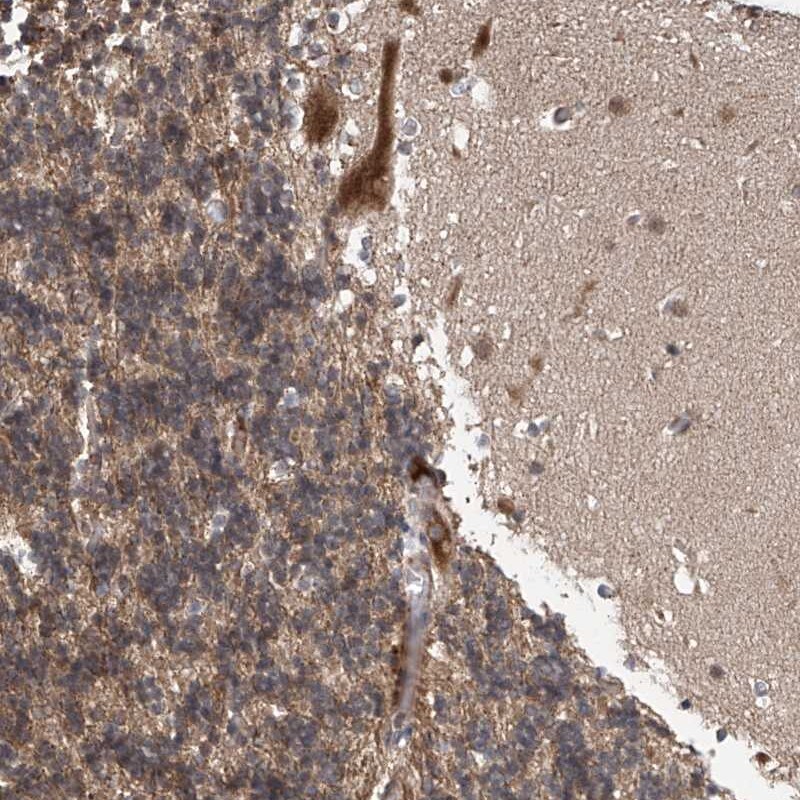 ABHD13 Antibody - BSA Free Immunohistochemistry-Paraffin: ABHD13 Antibody [NBP2-38205]