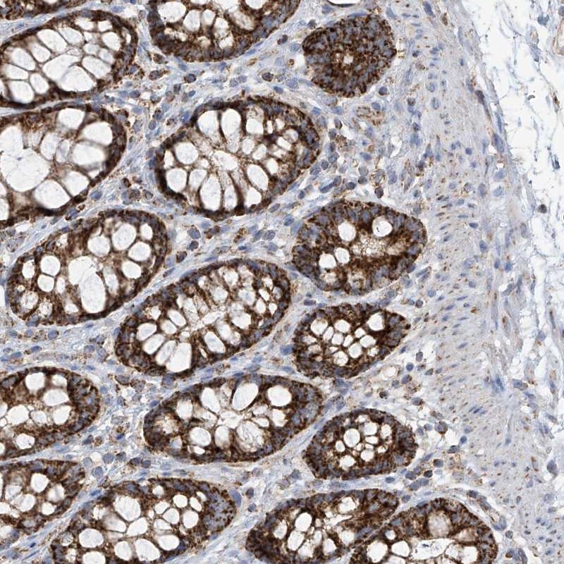 PNPT1 Antibody - BSA Free Immunohistochemistry-Paraffin: PNPT1 Antibody [NBP2-38211]
