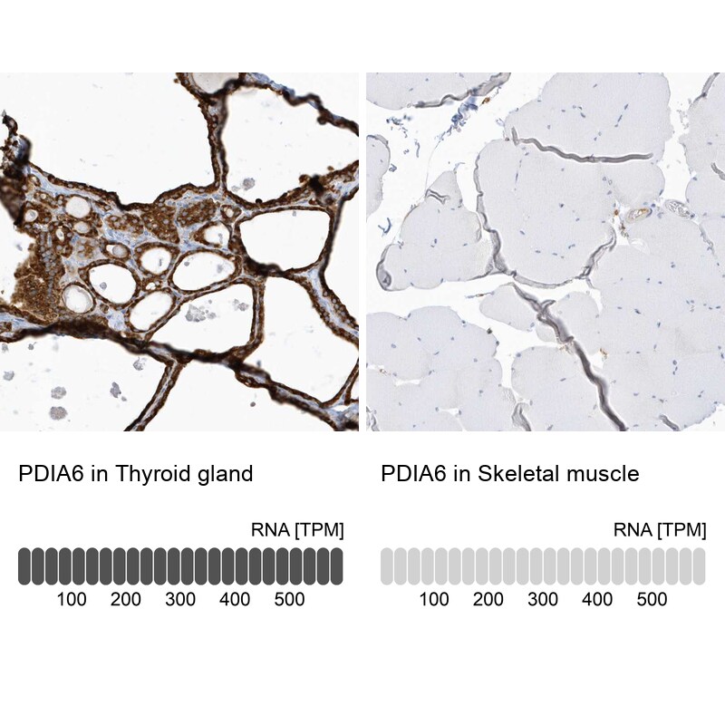 PDIA6 Antibody - BSA Free Immunohistochemistry-Paraffin: PDIA6 Antibody [NBP2-38213]