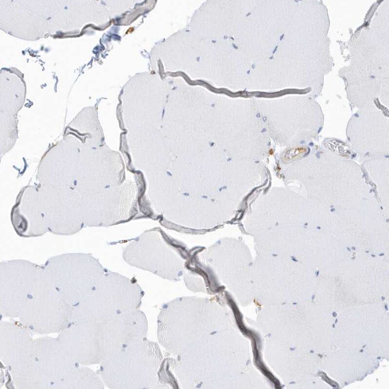 PDIA6 Antibody - BSA Free Immunohistochemistry-Paraffin: PDIA6 Antibody [NBP2-38213]