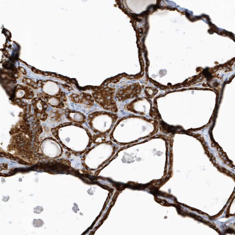 PDIA6 Antibody - BSA Free Immunohistochemistry-Paraffin: PDIA6 Antibody [NBP2-38213]