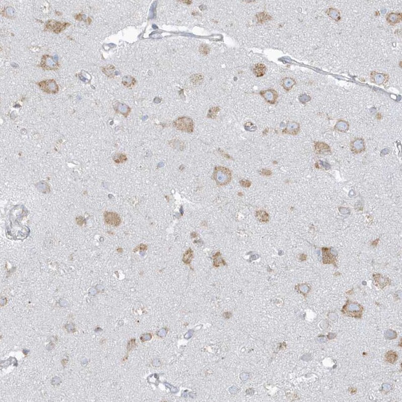 PDIA6 Antibody - BSA Free Immunohistochemistry-Paraffin: PDIA6 Antibody [NBP2-38213]