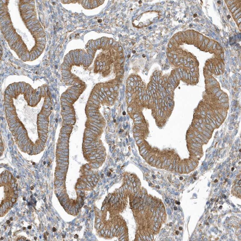 PDIA6 Antibody - BSA Free Immunohistochemistry-Paraffin: PDIA6 Antibody [NBP2-38213]