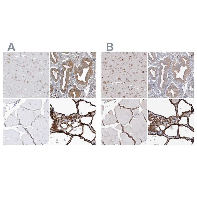 PDIA6 Antibody - BSA Free Immunohistochemistry-Paraffin: PDIA6 Antibody [NBP2-38213]
