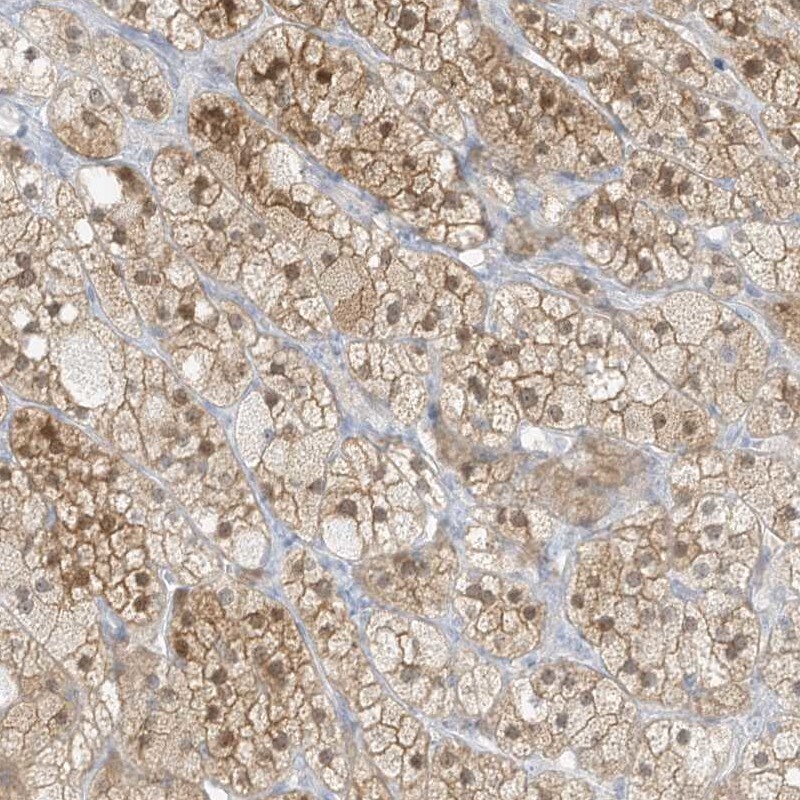 ZBTB41 Antibody - BSA Free Immunohistochemistry: ZBTB41 Antibody - BSA Free [NBP2-38224]
