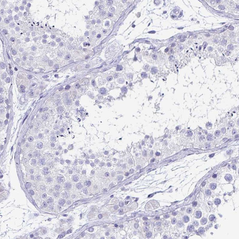 Ikaros/IKZF1 Antibody - BSA Free Immunohistochemistry-Paraffin: Ikaros/IKZF1 Antibody [NBP2-38241]