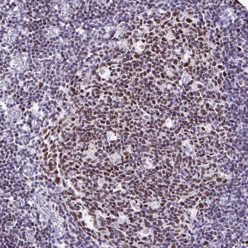Ikaros/IKZF1 Antibody - BSA Free Immunohistochemistry-Paraffin: Ikaros/IKZF1 Antibody [NBP2-38241]