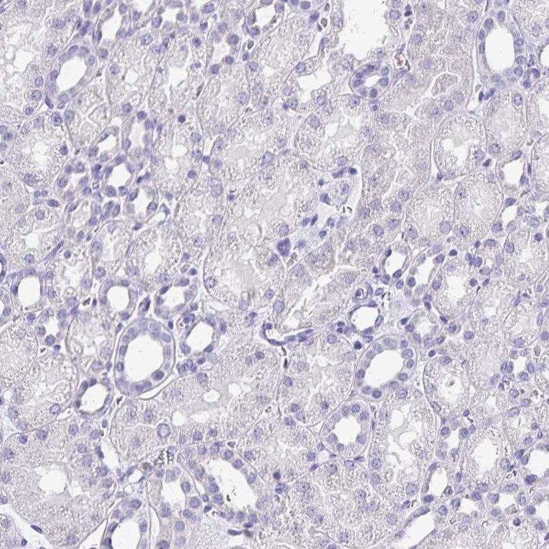 Ikaros/IKZF1 Antibody - BSA Free Immunohistochemistry-Paraffin: Ikaros/IKZF1 Antibody [NBP2-38241]
