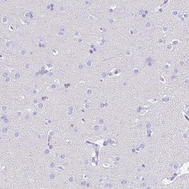 Ikaros/IKZF1 Antibody - BSA Free Immunohistochemistry-Paraffin: Ikaros/IKZF1 Antibody [NBP2-38241]