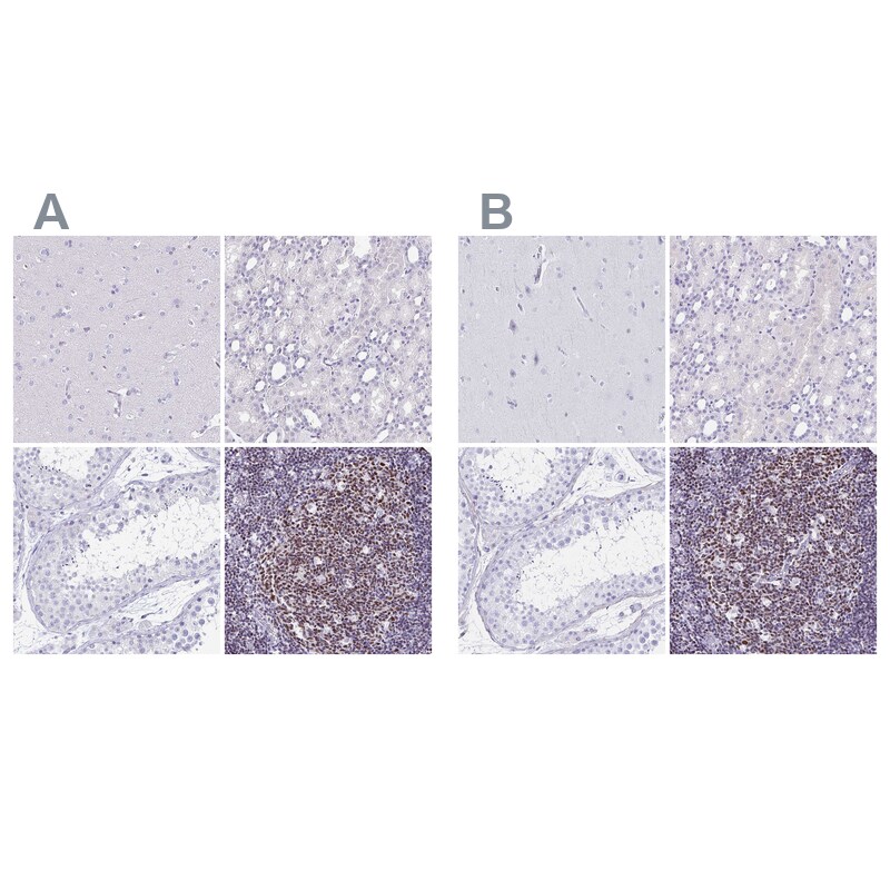 Ikaros/IKZF1 Antibody - BSA Free Immunohistochemistry-Paraffin: Ikaros/IKZF1 Antibody [NBP2-38241]