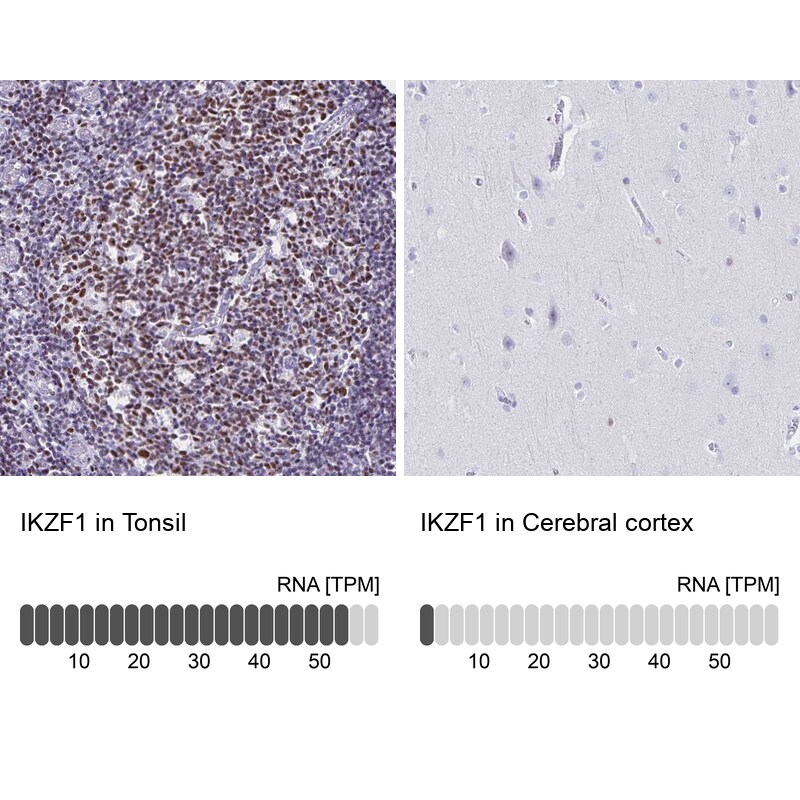 Ikaros/IKZF1 Antibody - BSA Free Immunohistochemistry-Paraffin: Ikaros/IKZF1 Antibody [NBP2-38242]