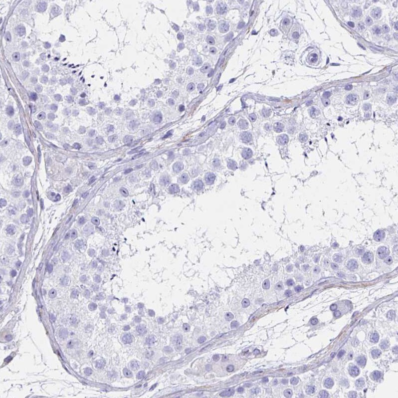 Ikaros/IKZF1 Antibody - BSA Free Immunohistochemistry-Paraffin: Ikaros/IKZF1 Antibody [NBP2-38242]