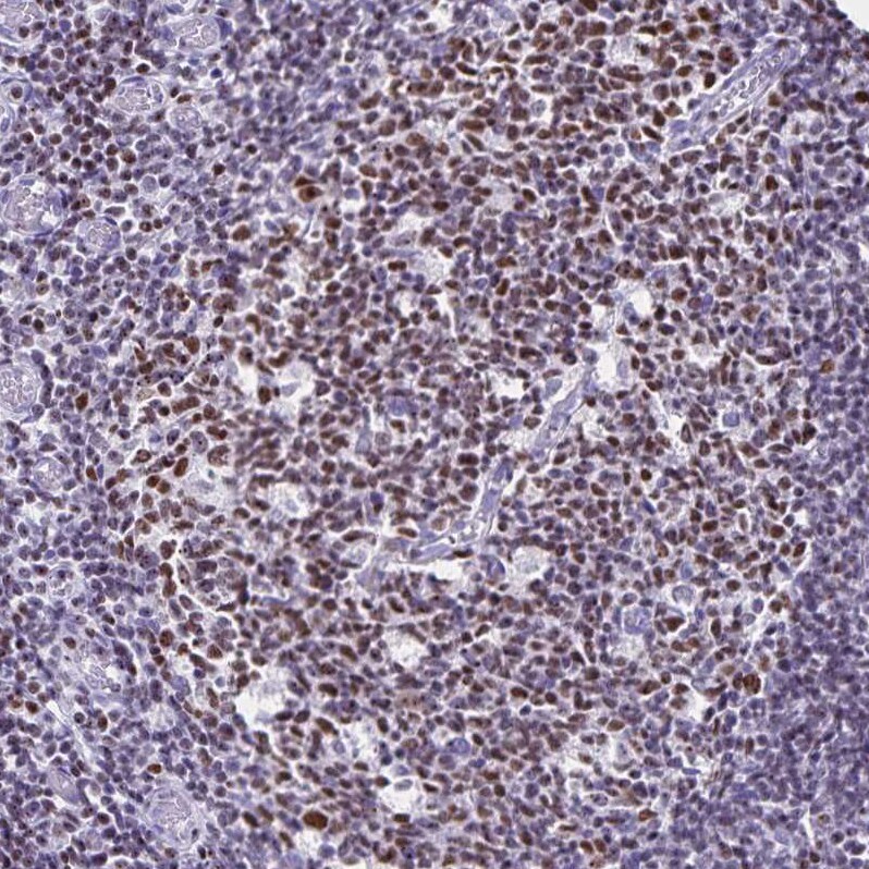 Ikaros/IKZF1 Antibody - BSA Free Immunohistochemistry-Paraffin: Ikaros/IKZF1 Antibody [NBP2-38242]