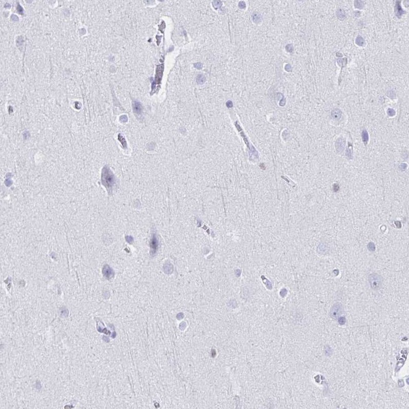 Ikaros/IKZF1 Antibody - BSA Free Immunohistochemistry-Paraffin: Ikaros/IKZF1 Antibody [NBP2-38242]