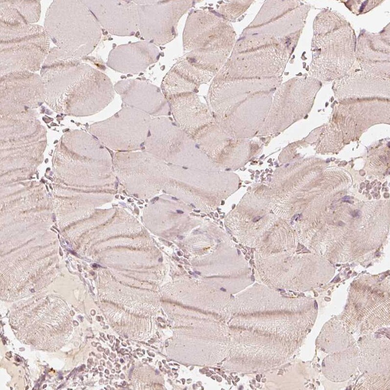 GRASP55 Antibody - BSA Free Immunohistochemistry-Paraffin: GRASP55 Antibody [NBP2-38244]