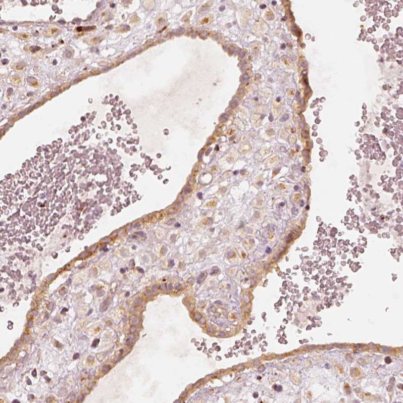 GRASP55 Antibody - BSA Free Immunohistochemistry-Paraffin: GRASP55 Antibody [NBP2-38244]