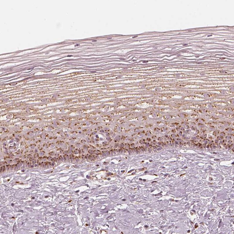 GRASP55 Antibody - BSA Free Immunohistochemistry-Paraffin: GRASP55 Antibody [NBP2-38244]
