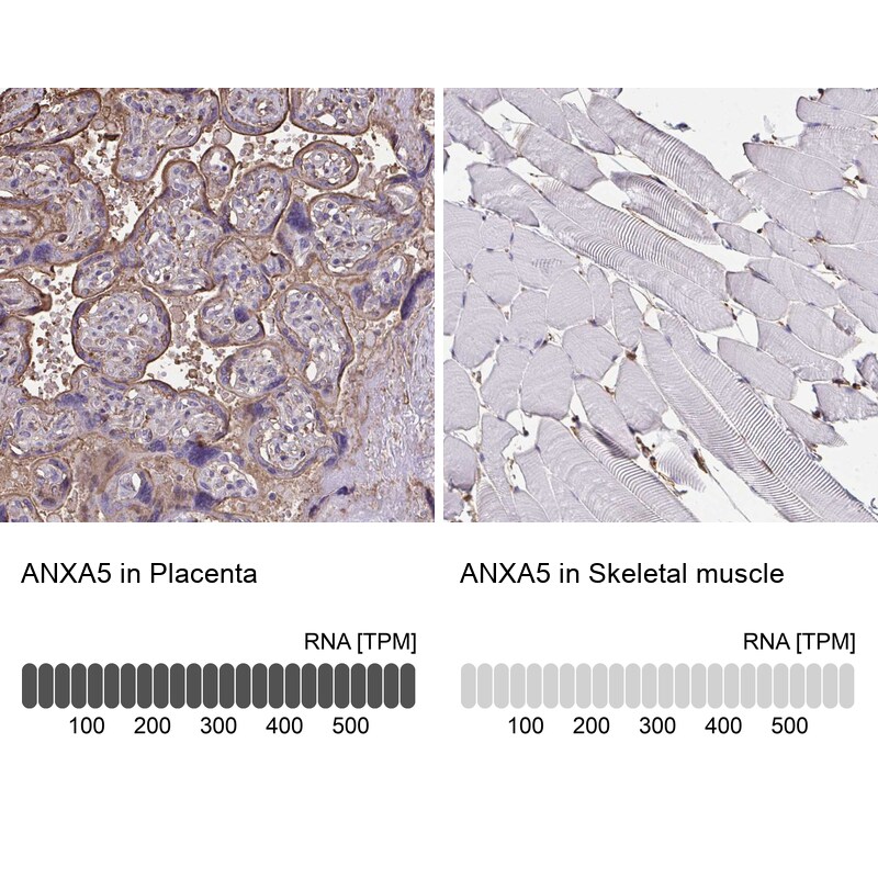 Annexin V Antibody - BSA Free Immunohistochemistry-Paraffin: Annexin V Antibody [NBP2-38248]