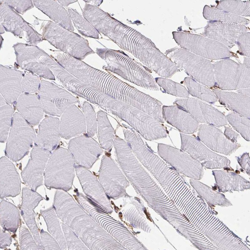 Annexin V Antibody - BSA Free Immunohistochemistry-Paraffin: Annexin V Antibody [NBP2-38248]