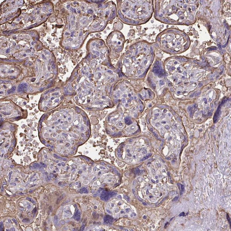 Annexin V Antibody - BSA Free Immunohistochemistry-Paraffin: Annexin V Antibody [NBP2-38248]
