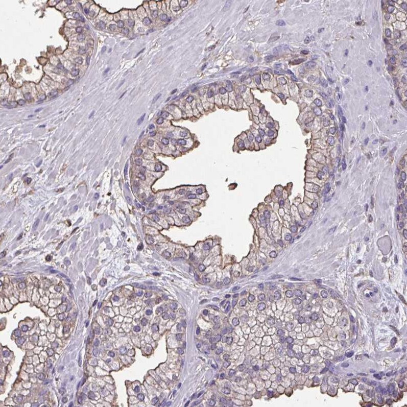 Annexin V Antibody - BSA Free Immunohistochemistry-Paraffin: Annexin V Antibody [NBP2-38248]