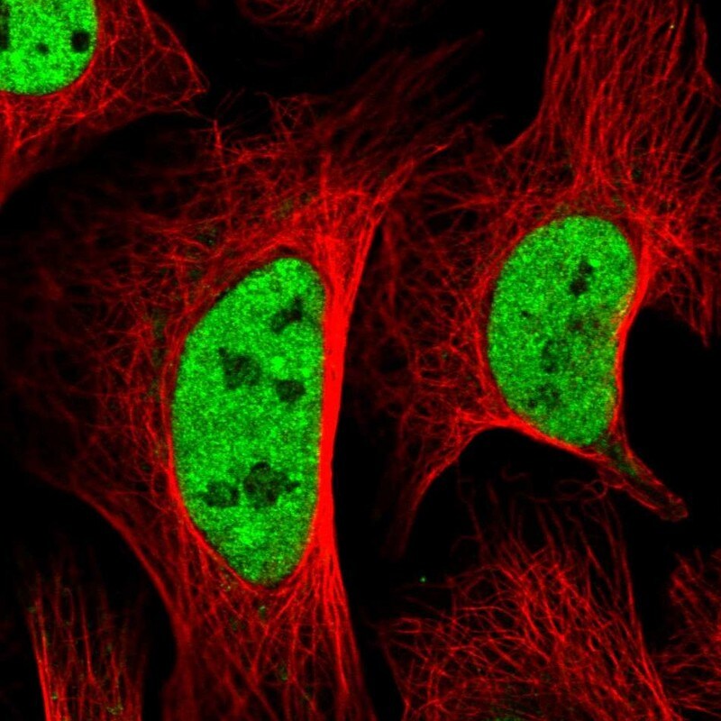 SETD5 Antibody - BSA Free Immunocytochemistry/ Immunofluorescence: SETD5 Antibody [NBP2-38257]