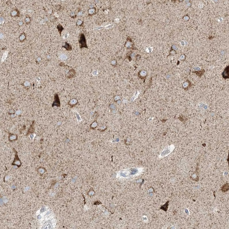 RPP40 Antibody - BSA Free Immunohistochemistry: RPP40 Antibody - BSA Free [NBP2-38260]