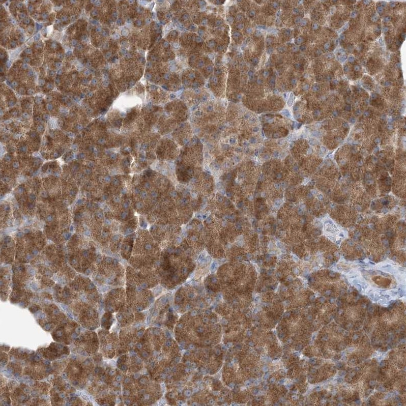 RPP40 Antibody - BSA Free Immunohistochemistry: RPP40 Antibody - BSA Free [NBP2-38260]