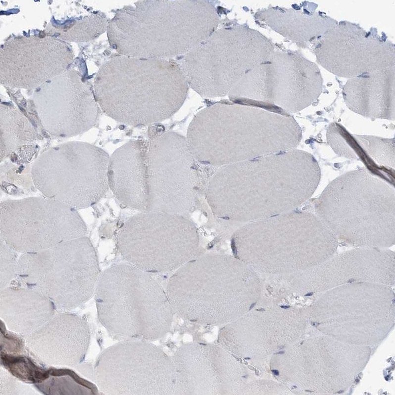 RPP40 Antibody - BSA Free Immunohistochemistry: RPP40 Antibody - BSA Free [NBP2-38260]
