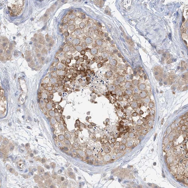 RPP40 Antibody - BSA Free Immunohistochemistry: RPP40 Antibody - BSA Free [NBP2-38260]