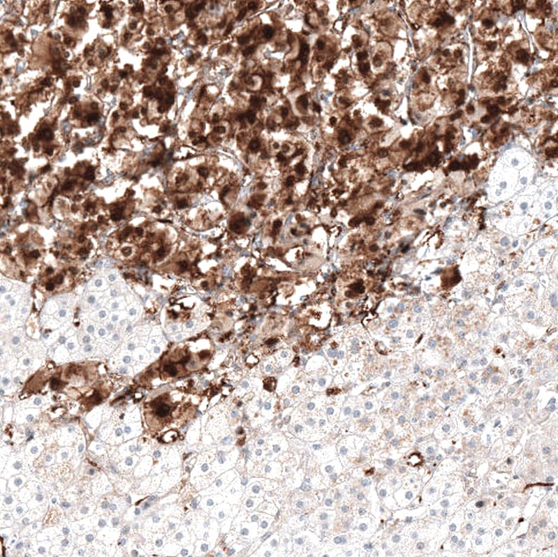 TrkA Antibody - BSA Free Immunohistochemistry-Paraffin: TrkA Antibody [NBP2-38265]
